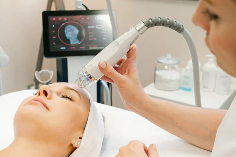 Радиофреквентна микроиглена РФ лифтинг без скалпела