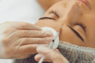 Шта је Relfydess Botox